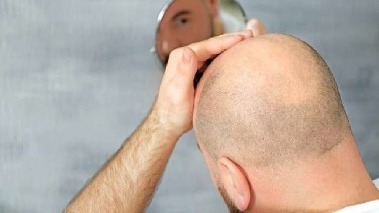 الرجل الأصلع أكثر نضجاً وذكاء وصدقاً وجاذبية 