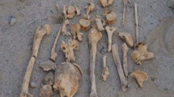 العثور على عظام بشرية داخل حاوية نفايات يستنفر أمن أكادير